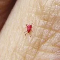 chiggers bugs