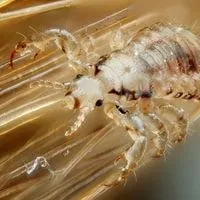 head lice