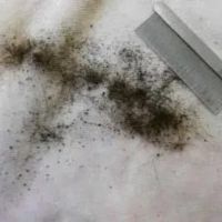 Flea Dirt On Bed Sheets 2023
