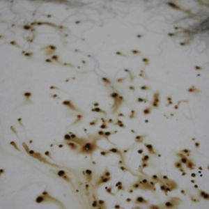 Flea Dirt On Bed Sheets